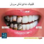 دندانپزشکی سروش