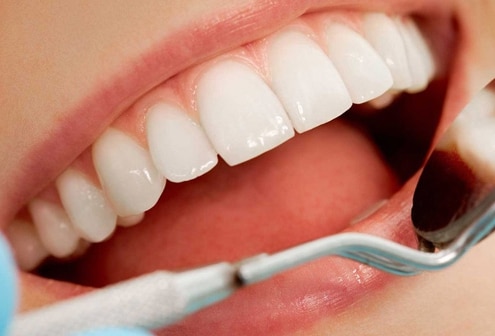 مزایای روش ایمپلنت دندان